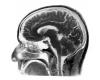 Régénérer le cerveau vieillissant | Le devoir – .